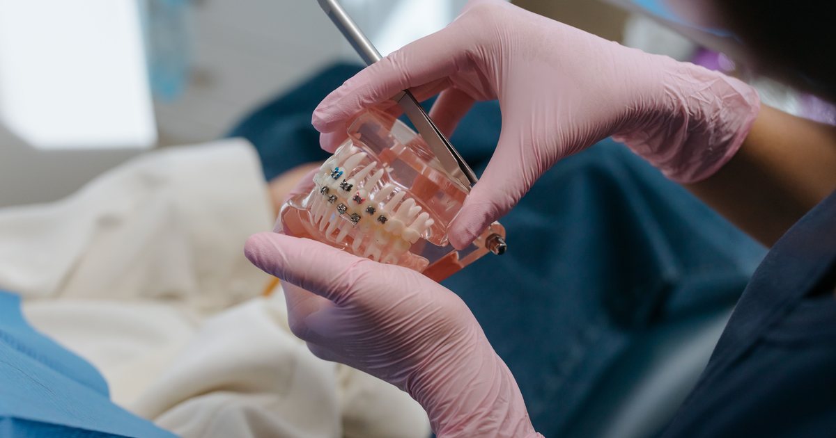 Manos con guantes sosteniendo un modelo dental